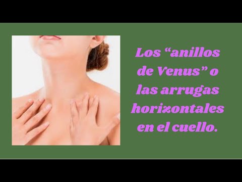 Anillos de Venus: la clave para rejuvenecer tu cuello | Actualizado